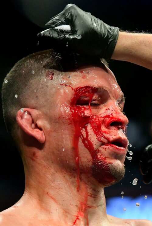 Nate Diaz Wallpaper