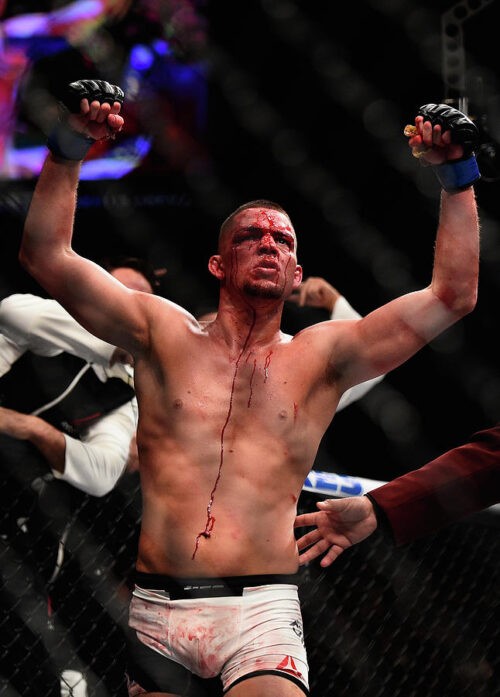 Nate Diaz Wallpaper